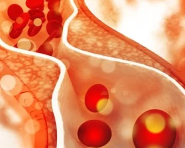 Simptomi da vam se u telu pojavio tromb: Obratite pažnju, ovo su znaci koje ne smete da ignorišete
